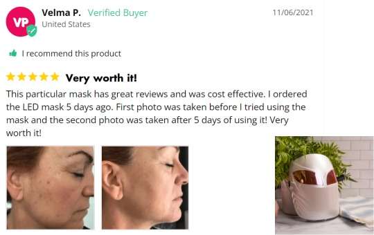 derma mask customer review before and after pic